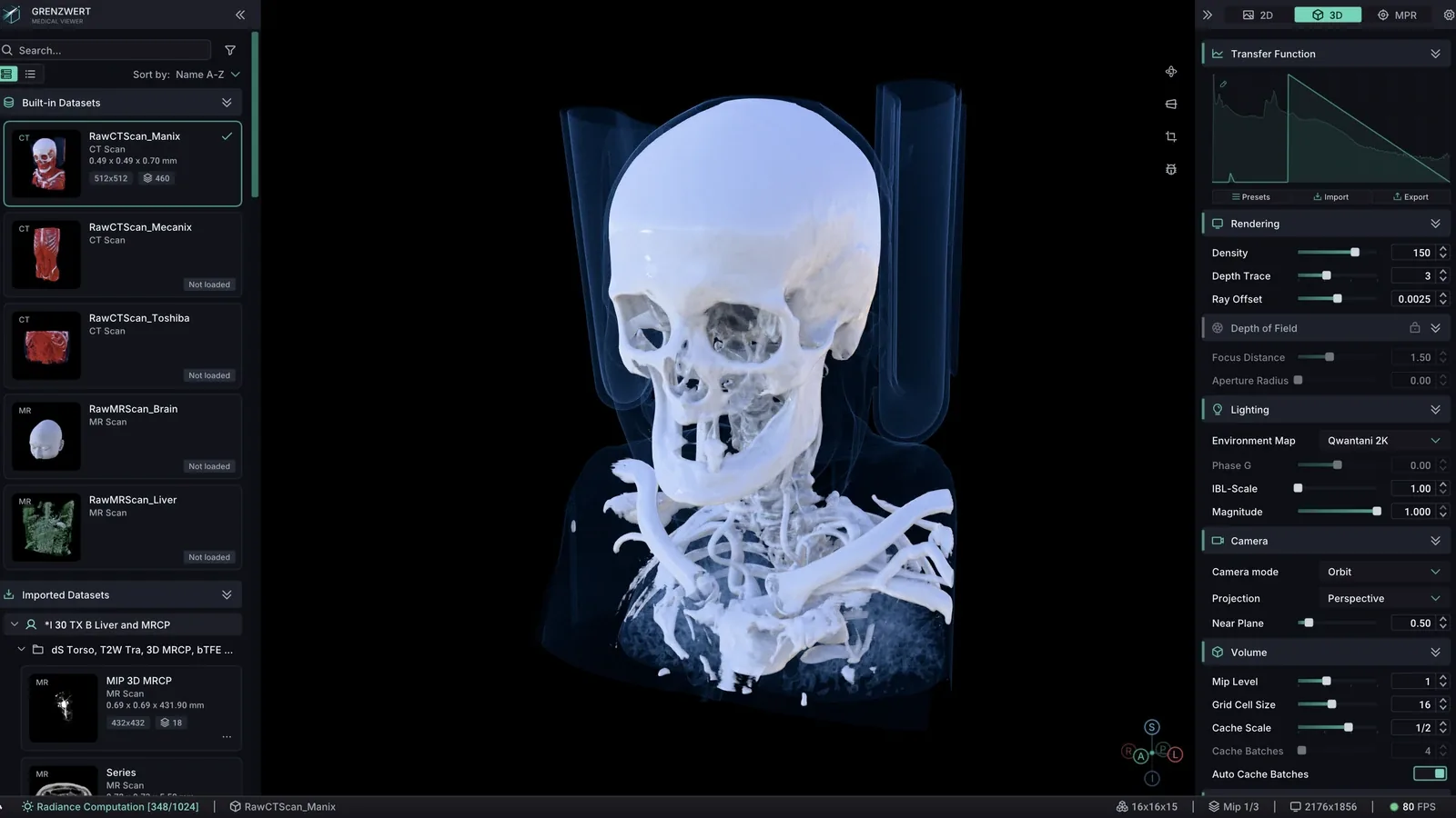 Área de renderização volumétrica 3D do Grenzwert com anatomia de TC e controles de renderização