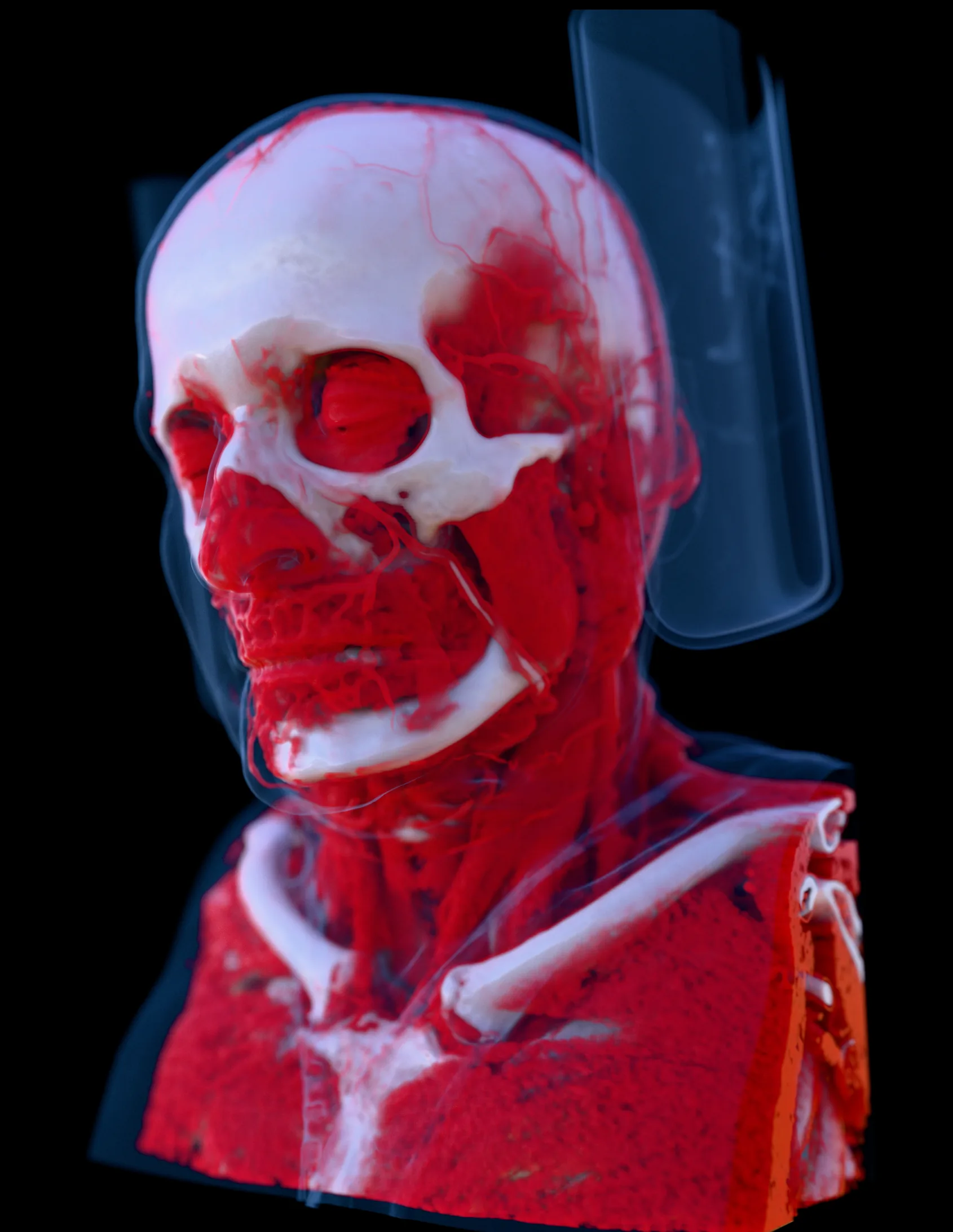 КТ головы MANIX в 3D с костями и красными мягкими тканями