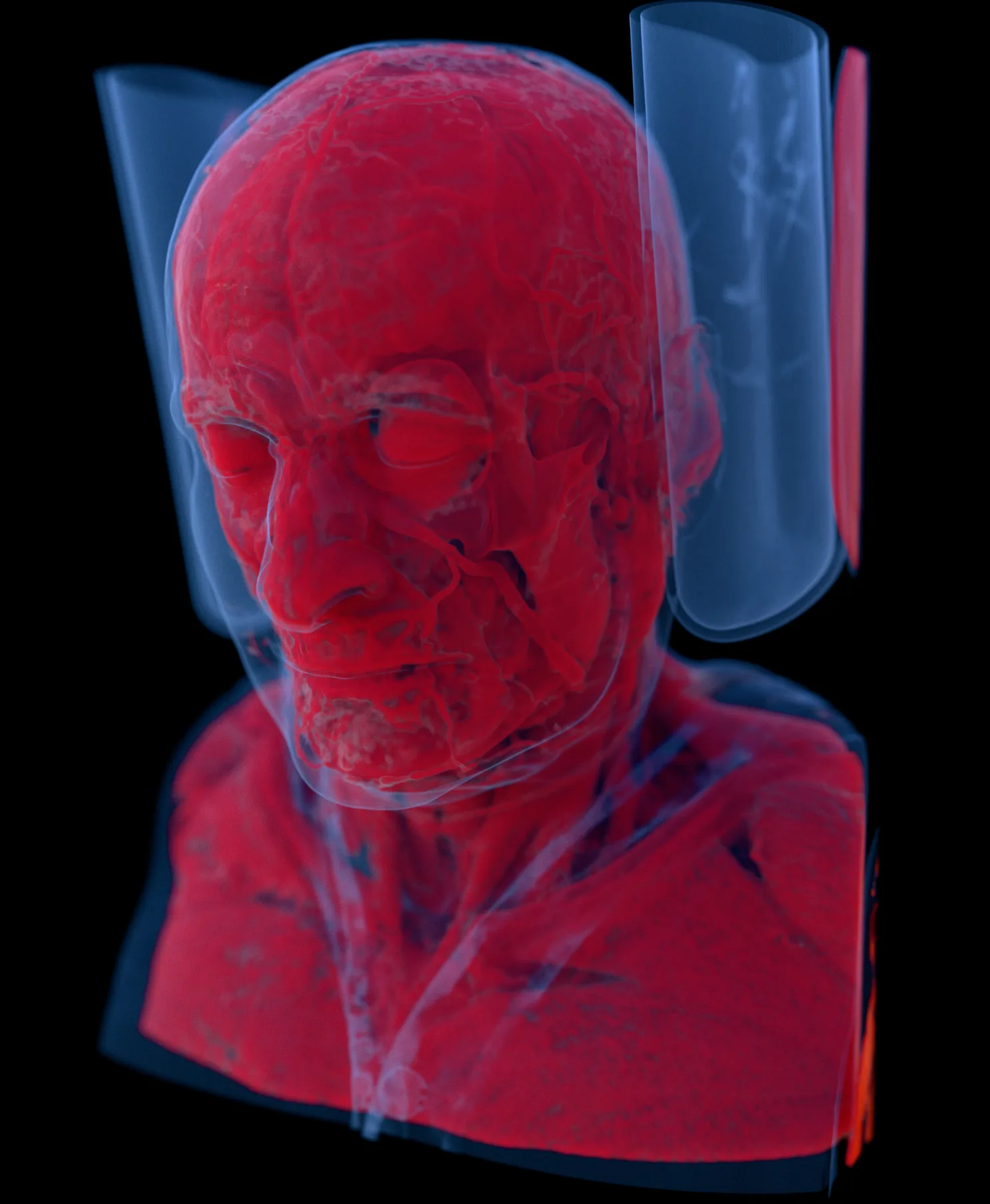 КТ головы MANIX в 3D с прозрачными красными тканями и объёмом отсечения